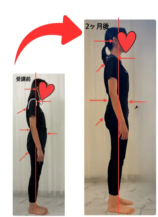 Sさんビフォーアフター