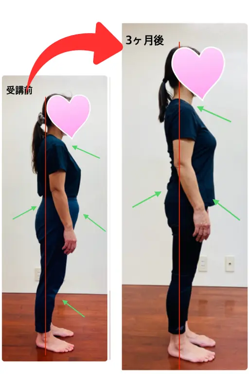 Cさんビフォアフター