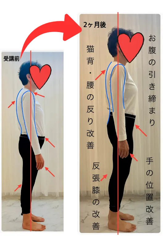 Sさんビフォアフター