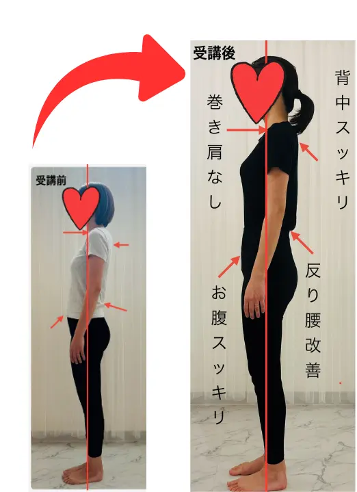 Kさんビフォアフター