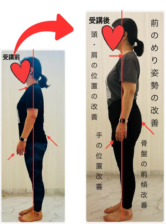 Mさんビフォアフター