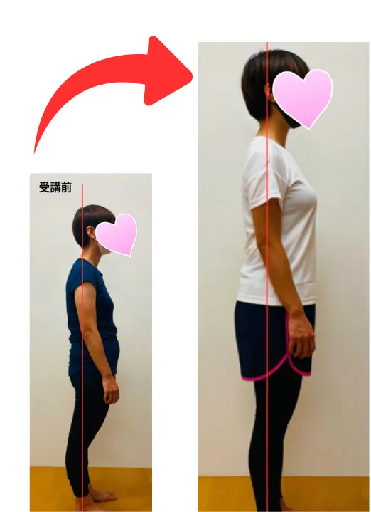 Oさんビフォーアフター